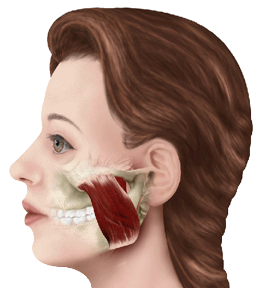 Dr. Rich Hirschinger Beverly Hills Facial Pain Migraines Headaches