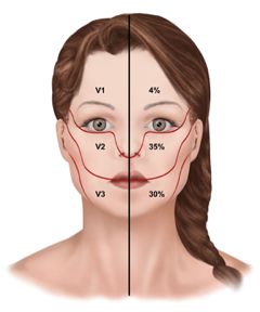 Diagnosing Neuropathic Pain