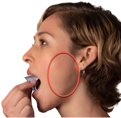 gentle-jaw-stretching-superficial-masseter-muscle.png