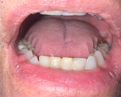Scalloped-tongue-2.png