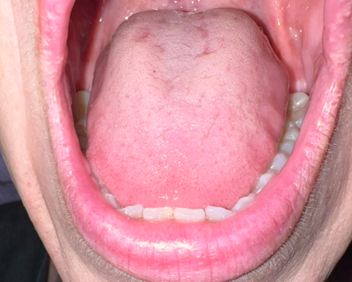 Scalloped-tongue-3.png
