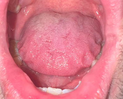 Scalloped-tongue-4.png