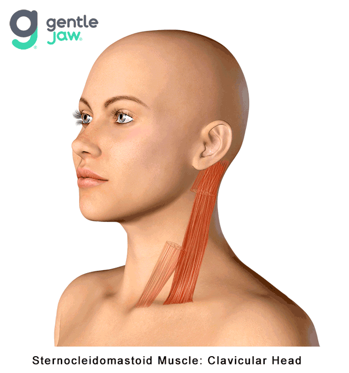 Muscle-Referral-Patterns-SCM-Clavicular.gif