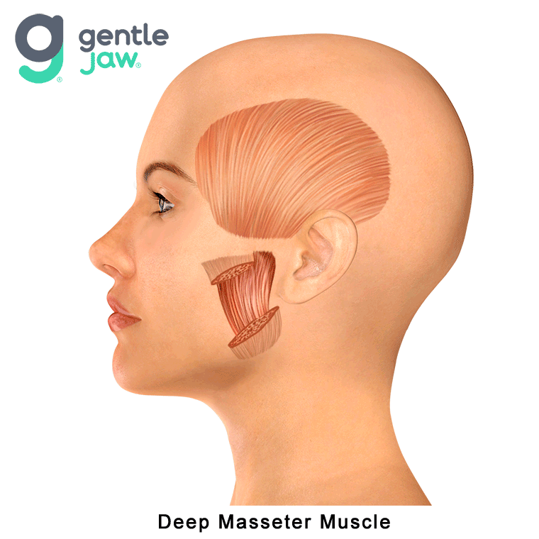 Muscle-Referral-Patterns-Deep-Masseter-Muscle.gif