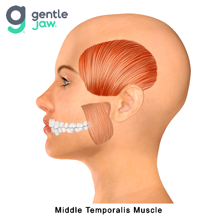 Jaw Closing Muscles That Refer Pain Into Teeth Muscle Referral Patterns Dr.  Rich Hirschinger Beverly Hills Facial Pain