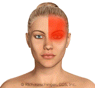 Causes Of Headaches Beverly Hills Los Angeles Dr Rich Hirschinger