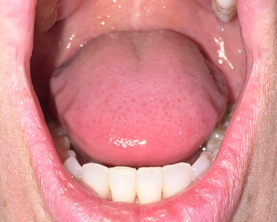 Scalloped-tongue-1.png